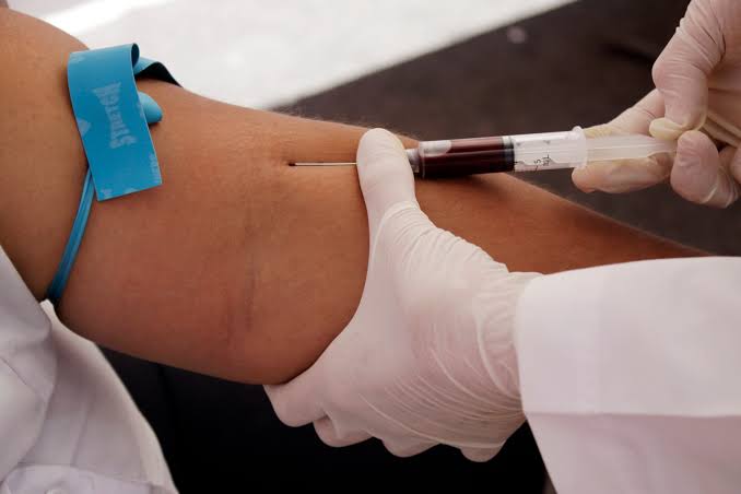 US approves first blood test for Alzheimer's