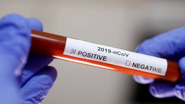 Bangladeshi tests positive for coronavirus in UAE