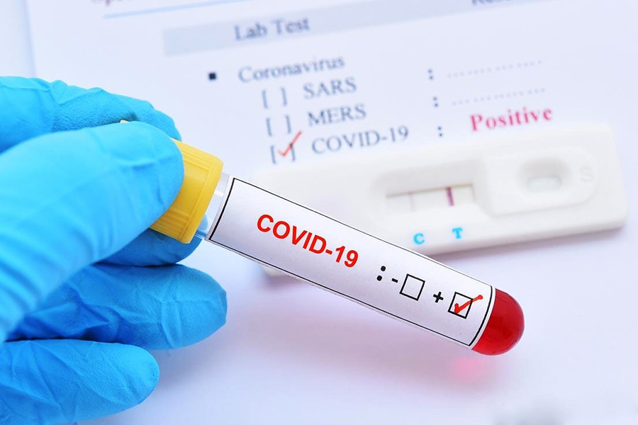 Two bank officials among six diagnosed with Covid-19 in Nilphamari