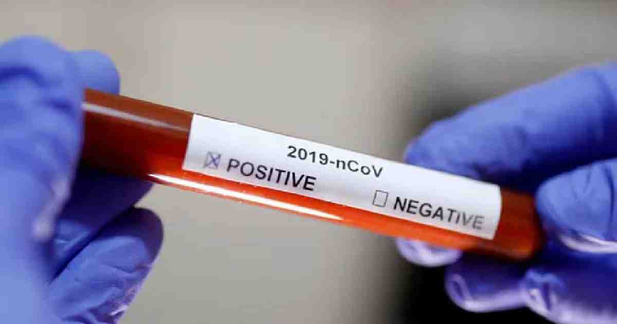 10-month-old baby tests positive for coronavirus in Chattogram: Official 