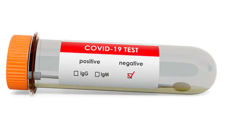 25 UK returnees test Covid negative after retest in 24 hrs