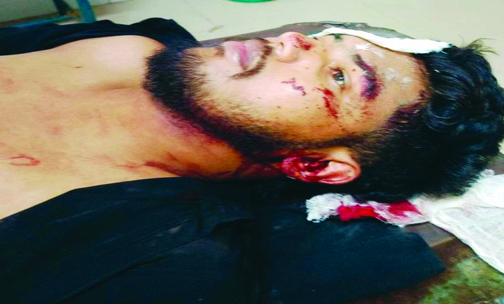 অভয়নগর এলাকার সন্ত্রাসী কর্মকান্ডে জড়িত বেপরোয়া চক্র, খুন জখম সন্ত্রাসী হামলার স্বীকার কলেজ ছাত্র এসএম সিফাতউল্লাহ